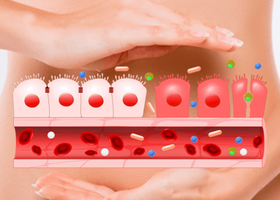 Signs and Symptoms of Leaky Gut